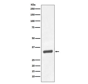 Western blot testing of human prostate carcinoma tissue lysate with PSA antibody. Predicted molecular weight: 30-34 kDa.