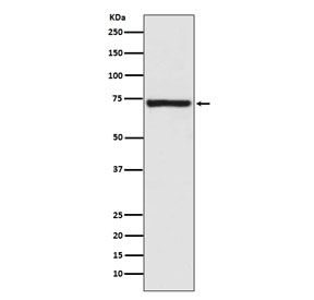 Western blot testing of human fetal kidney lysate with Calpain 1 antibody. Predicted molecular weight ~82 kDa.