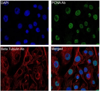IF/ICC staining of mouse NIH3T3 cells with Beta Tubulin antibody (red), PCNA antibody (green) and DAPI nuclear stain (blue).