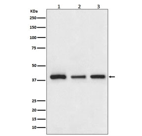 Western blot testing of 1) human HepG2, 2) mouse NIH3T3 and 3) rat PC-12 cell lysate with Cathepsin L/V/K/H antibody.