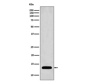 Western blot testing of human Jurkat cell lysate with Profilin 1 antibody. Predicted molecular weight ~15 kDa.