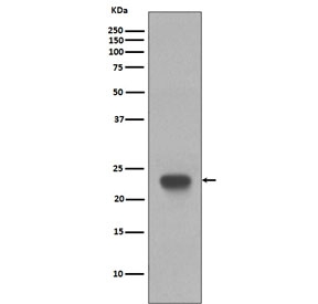 Western blot testing of human Jurkat cell lysate with CD3 epsilon antibody. Predicted molecular weight ~23 kDa.