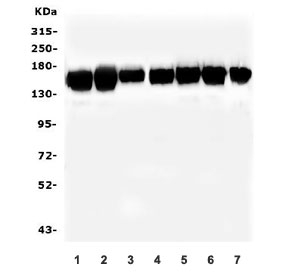 Western blot testing of human 1) K562, 2) HL-60, 3) U-2 OS, 4) U-87 MG, 5) HepG2, 6) ThP-1 and 7) A549 lysate with SMARCAD1 antibody. Predicted molecular weight ~117 kDa but can be observed at up to ~150 kDa.