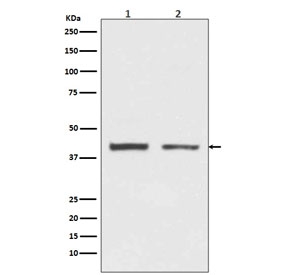 Western blot testing of human 1) HeLa and 2) HepG2 cell lysate with HNRNPC antibody. Expected molecular weight ~41 kDa (C1) and ~43 kDa (C2).