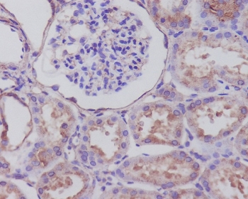 Syp Stained SYP Antibody | Rabbit Monoclonal | RQ5211 NSJ Bioreagents