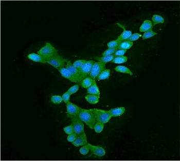 Immunofluorescent staining of FFPE human MCF7 cells with APOBEC3G antibody (green) and DAPI nuclear stain (blue). HIER: steam section in pH6 citrate buffer for 20 min.
