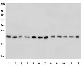 Western blot testing of human 1) placenta, 2) U937, 3) HL60, 4) U-2 OS, 5) U-87 MG, 6) K562, 7) HeLa, 8) rat thymus, 9) rat lung, 10) mouse lung, 11) mouse intestine and 12) mouse SP2/0 lysate with CDC42 antibody. Predicted molecular weight ~21 kDa.