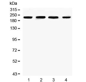 Western blot testing of human 1) K562, 2) HL60, 3) HEK293 and 4) PC-3 cell lysate with Ch-TOG antibody. Predicted molecular weight ~225 kDa.