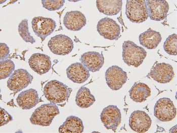 IHC staining of FFPE rat testis tissue with DAZAP1 antibody. HIER: boil tissue sections in pH6 citrate buffer for 20 min and allow to cool before testing.