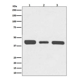 Western blot testing of 1) human HeLa, 2) mouse NIH3T3 and 3) rat PC-12 cell lysate with RPSA antibody. Routinely observed molecular weight: 37-40 kDa and 67 kDa.