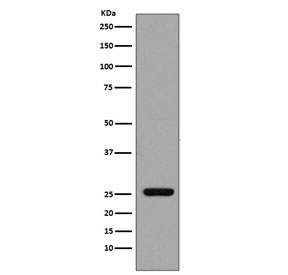 Western blot testing of human recombinant protein with GST pi antibody. Predicted molecular weight ~23 kDa.