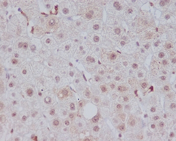 IHC staining of FFPE human liver tissue with Heme Oxygenase 1 antibody. HIER: boil tissue sections in pH6, 10mM citrate buffer, for 10-20 min and allow to cool before testing.