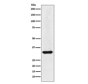 Western blot testing of human HepG2 cell lysate with HNRNPA1 antibody. Expected molecular weight: ~34 and/or 39 kDa.