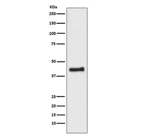 Western blot testing of human HEK293 cell lysate with NR2F1 antibody. Predicted molecular weight ~46 kDa.