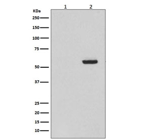Western blot testing of 1) lysate from alkaline phosphatase-treated SH-SY5Y cells and 2) lysate from untreated SH-SY5Y cells, with phospho-Tau antibody (pS396). The S396 site is naturally highly phosphorylated and negative testing results after phosphatase treatment demonstrates the specificity of the phospho-Tau antibody. Expected molecular weight: 50-80 kDa.