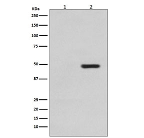 Western blot testing of 1) lysate from untreated SH-SY5Y cells and 2) lysate from sorbitol-treated SH-SY5Y cells, with phospho-Tau antibody (pT231). Expected molecular weight: 50-80 kDa.