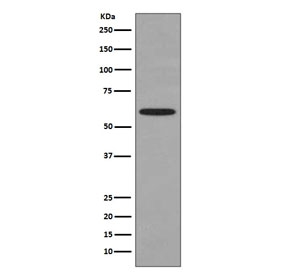Western blot testing of human HeLa cell lysate with HSPD1 antibody. Predicted molecular weight ~60 kDa.