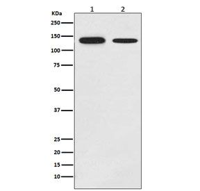 Western blot testing of 1) human MCF-7 and 2) mouse brain lysate with GHR antibody. Predicted molecular weight ~72 kDa but GHR can be glycosylated, ubiquitinated and complex with GH causing a larger than predicted size to be observed.