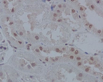 IHC staining of FFPE rat kidney tissue with IRF1 antibody. HIER: boil tissue sections in pH6, 10mM citrate buffer, for 10-20 min and allow to cool before testing.