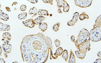 IHC staining of FFPE human placenta with MID1 antibody. HIER: boil tissue sections in pH6, 10mM citrate buffer, for 20 min and allow to cool before testing.