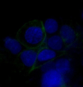 Immunofluorescent staining of human HepG2 cells with GLUT1 antibody (green) and DAPI nuclear stain (blue).
