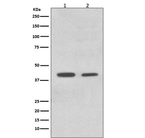 Western blot testing of human 1) HeLa and 2) K562 cell lysate with Mcad antibody. Predicted molecular weight ~46 kDa.