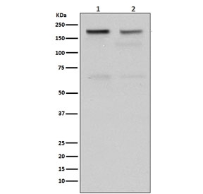 Western blot testing of human 1) HeLa and 2) Jurkat cell lysate with TOP2A antibody. Predicted molecular weight ~174 kDa.