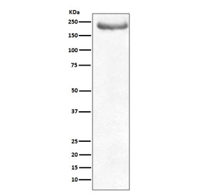 Western blot testing of human brain lysate with NF-H antibody. Predicted molecular weight ~200 kDa.