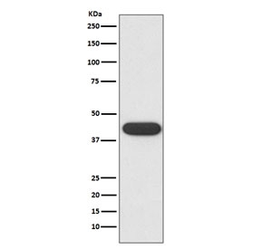 Western blot testing of human K562 cell lysate with CD32 antibody. Expected molecular weight: 34-40 kDa depending on the level of glycosylation.