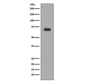 Western blot testing of human HepG2 cell lysate with ALAS1 antibody. Predicted molecular weight ~71 kDa.