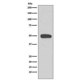 Western blot testing of human A431 cell lysate with KRT13 antibody. Predicted molecular weight ~50 kDa.