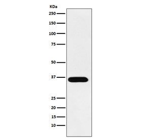 Western blot testing of human A431 cell lysate with ACP5 antibody. Predicted molecular weight ~36 kDa.