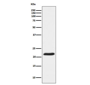 Western blot testing of human HeLa cell lysate with TCTP antibody. Predicted molecular weight ~20 kDa.