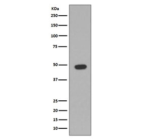 Western blot testing of rat brain lysate with GFAP antibody. Predicted molecular weight ~50 kDa.