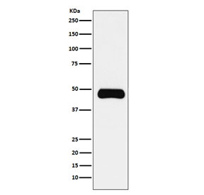 Western blot testing of human Daudi cell lysate with ETS1 antibody. Predicted molecular weight ~51 kDa.