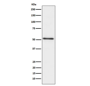 Western blot testing of human prostate cancer lysate with ACPP antibody. Expected molecular weight: 45-50 kDa.