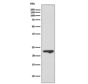 Western blot testing of human T-47D cell lysate with Mucin-1 antibody. Expected molecular weight: 17-25 kDa depending on glycosylation level.
