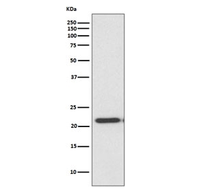 Western blot testing of human HeLa cell lysate with TIMP2 antibody. Predicted molecular weight ~24 kDa.