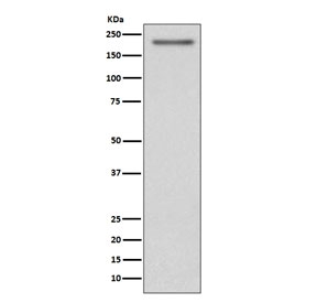 Western blot testing of human SH-SY5Y cell lysate with PDGFRA antibody. Expected molecular weight: 120-195 kDa.