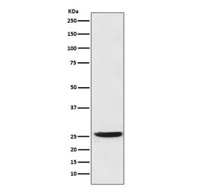 Western blot testing of human SW480 cell lysate with 15-PGDH antibody. Predicted molecular weight: ~29 kDa.