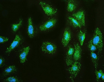 Immunofluorescent staining of FFPE human U-2 OS cells with MMP1 antibody (green) and DAPI (blue). HIER: boil tissue sections in pH6, 10mM citrate buffer, for 20 min and allow to cool before testing.