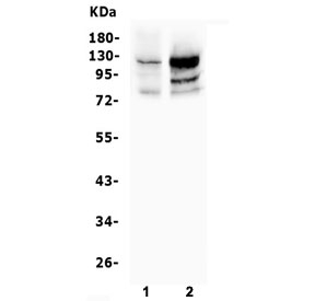 Western blot testing of human 1) U-2 OS and 2) K562 cell lysate with NFAT2 antibody. Predicted molecular weight: ~77 kDa (isoform A), ~88 kDa (isoform B), ~101 kDa (isoform C).
