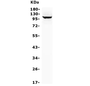 Western blot testing of human HepG2 cell lysate with MTTP antibody. Predicted molecular weight ~99 kDa.