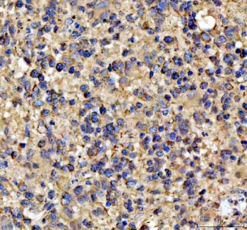 Flow cytometry testing of fixed and permeabilized human U-2 OS cells with NOTCH2 antibody at 1ug/million cells (blocked with goat sera); Red=cells alone, Green=isotype control, Blue= NOTCH2 antibody.