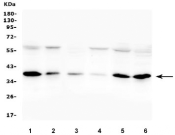 Western blot testing of human 1) A375, 2) Jurkat, 3) A549, 4) A431, 5) HepG2 and 6) K562 cell lysate with Orai1 antibody. Predicted molecular weight: 33-50 kDa depending on glycosylation level.