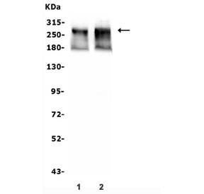 Western blot testing of human 1) A549 and 2) HeLa lysate with ATRX antibody. Expected molecular weight ~280 kDa.