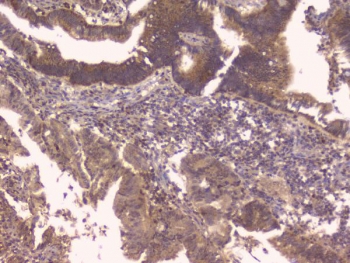 IHC staining of FFPE human placenta with TNFRSF11B antibody. HIER: boil tissue sections in pH6, 10mM citrate buffer, for 20 min and allow to cool before testing.