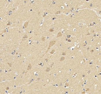 IHC staining of FFPE human brain tissue with SKP1 antibody. HIER: boil tissue sections in pH8 EDTA buffer for 20 min and allow to cool before testing.