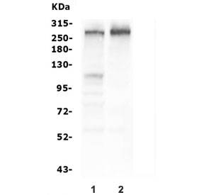 Western blot testing of human 1) HEK293 and 2) PC-3 cell lysate with Tuberin antibody. Expected molecular weight: 200~220 kDa.