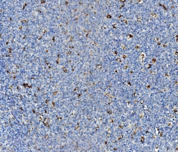 IHC staining of FFPE human tonsil with Niemann Pick C2 antibody. HIER: boil tissue sections in pH8 EDTA for 20 min and allow to cool before testing.
